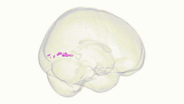 Full Brain White