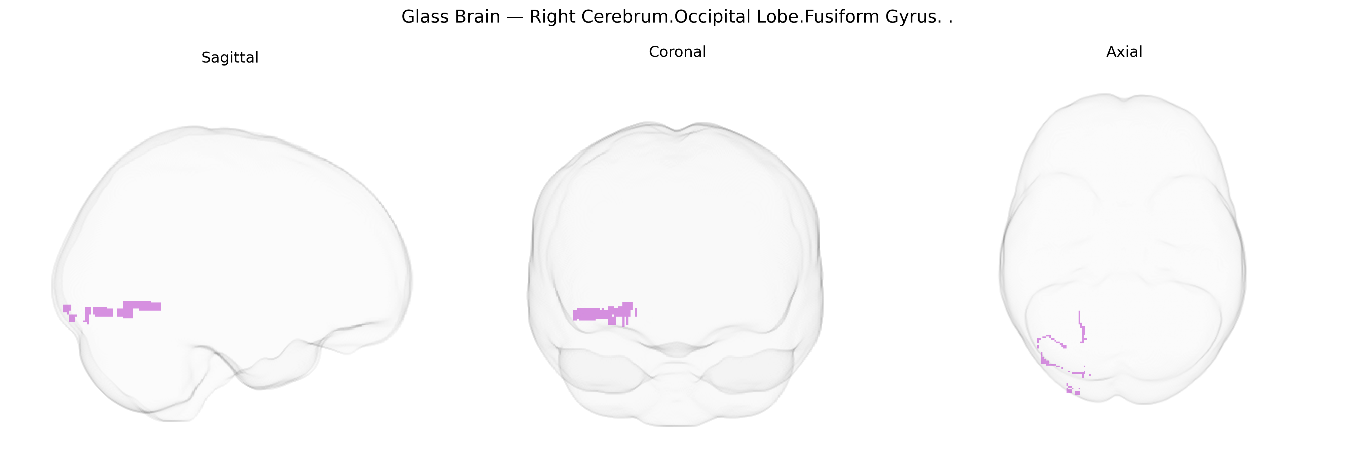 Triplanar Ghost Brain