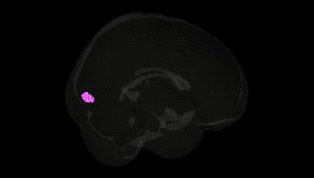 Full Brain Black
