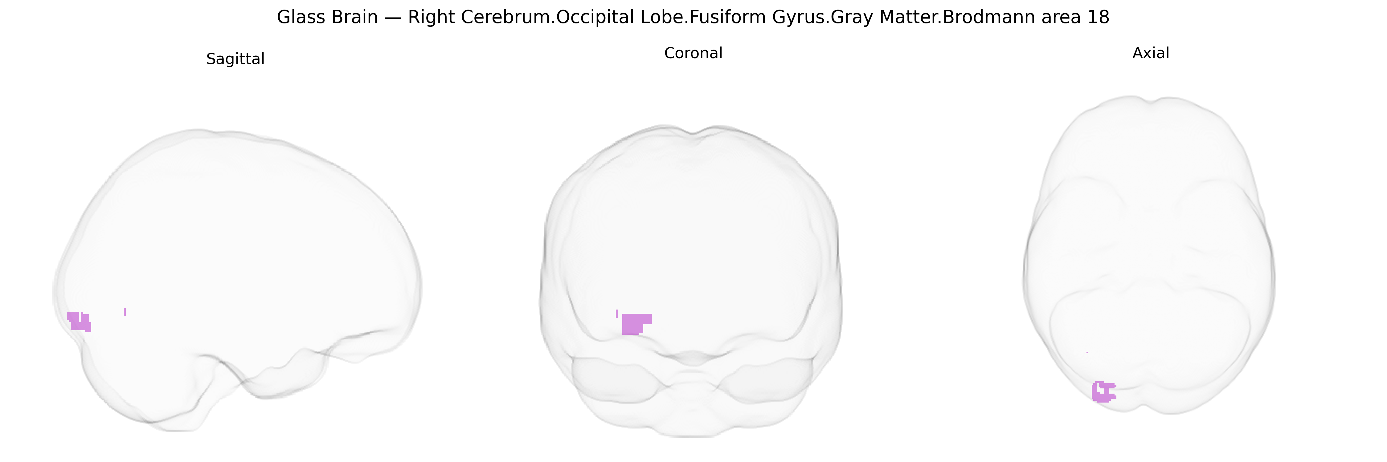 Triplanar Ghost Brain