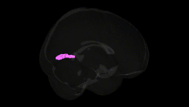 Full Brain Black