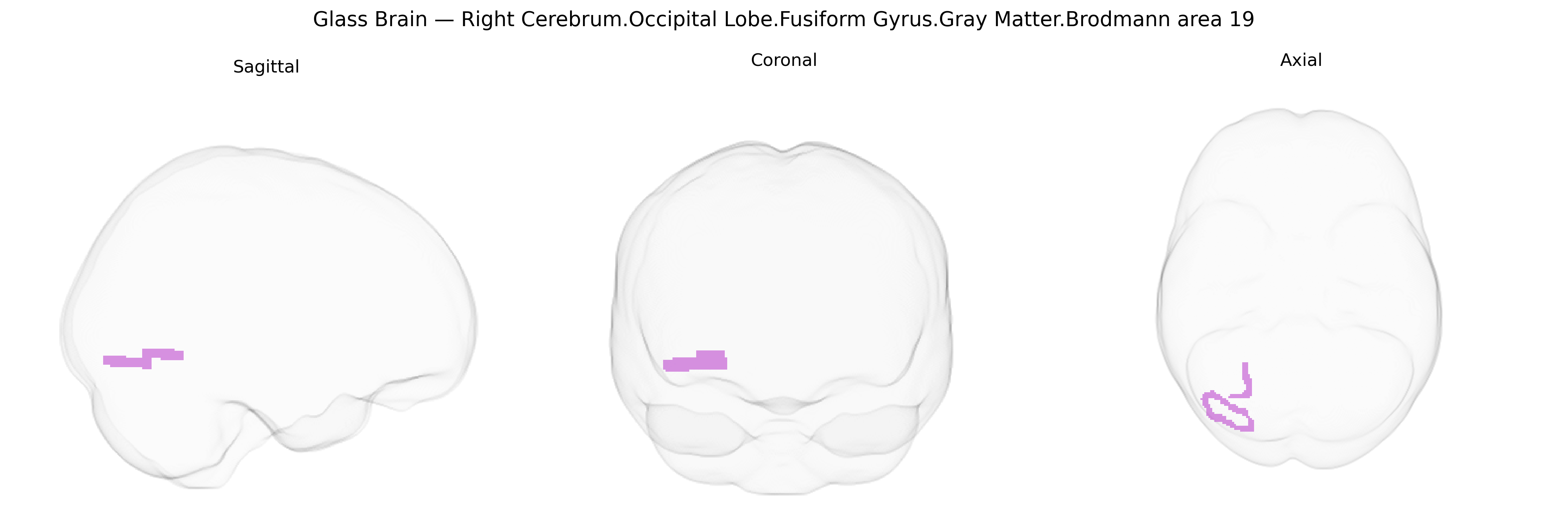 Triplanar Ghost Brain