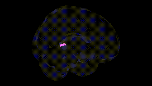 Full Brain Black
