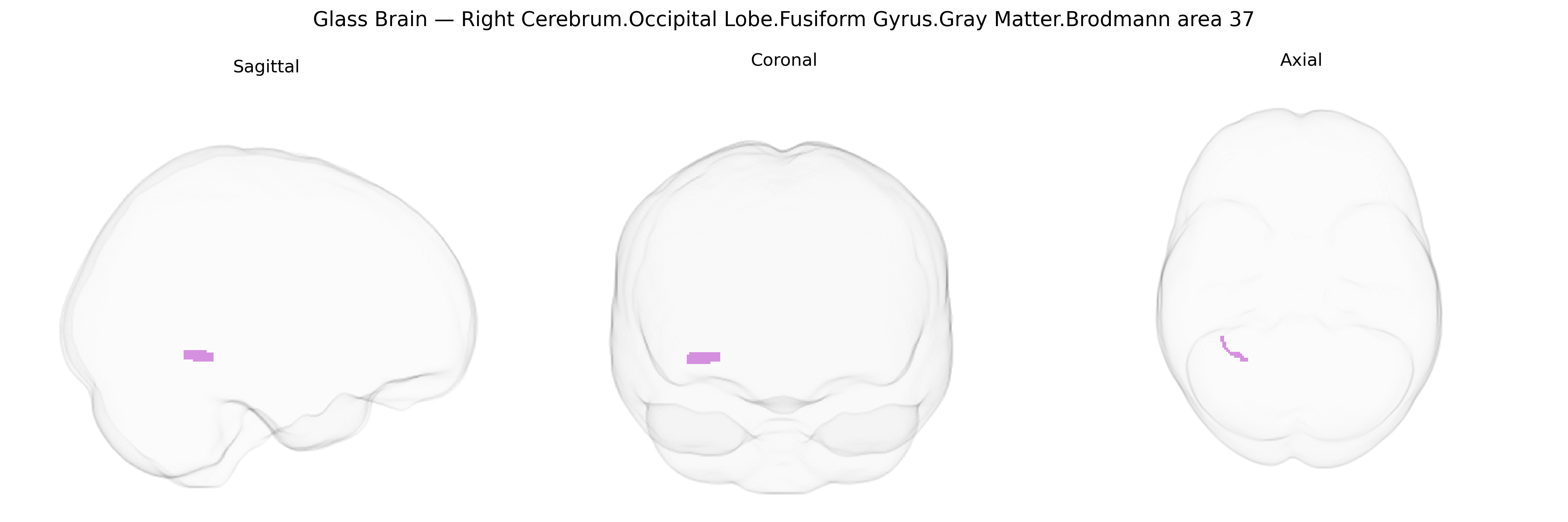 Triplanar Ghost Brain