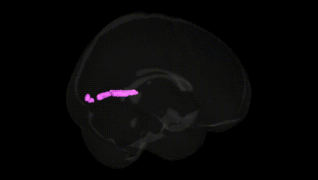 Full Brain Black