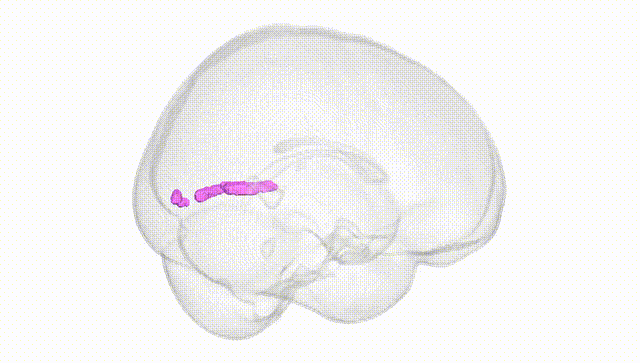 Full Brain White