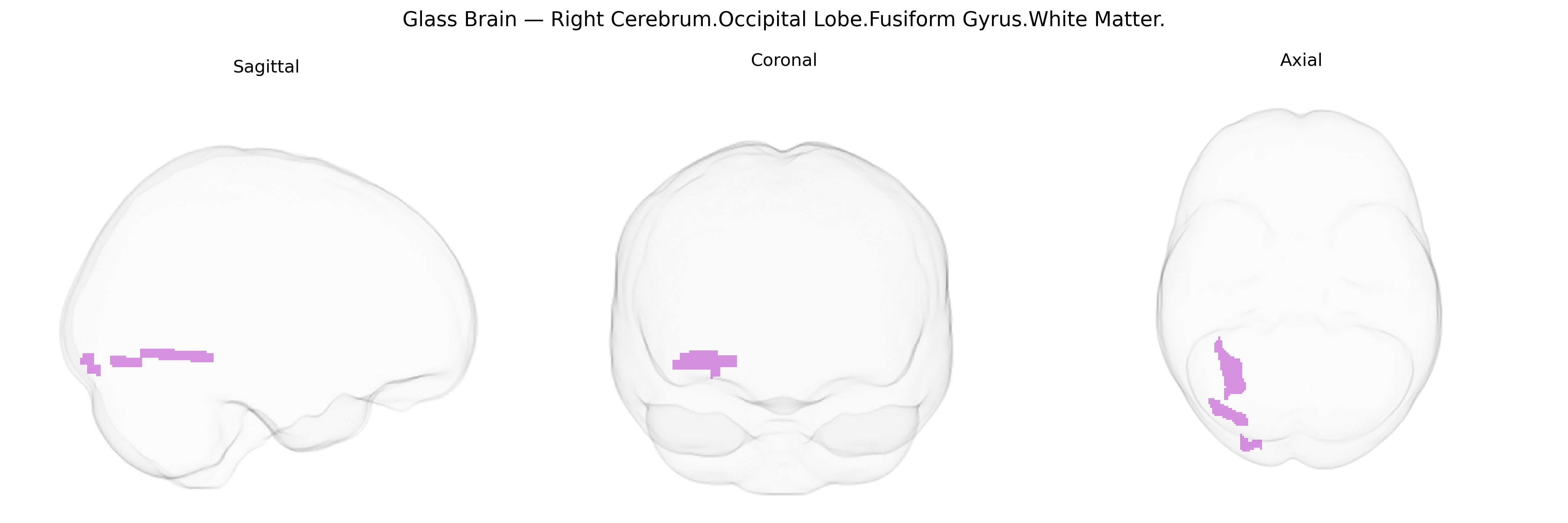 Triplanar Ghost Brain