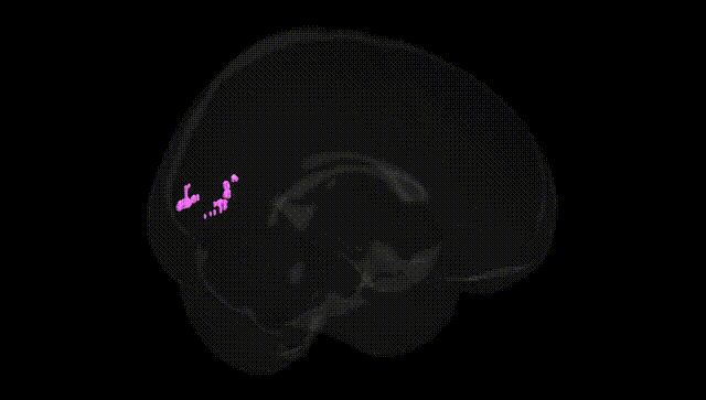 Full Brain Black