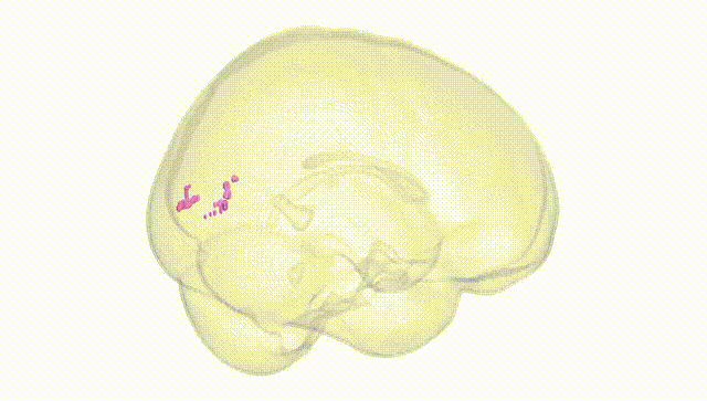 Full Brain White