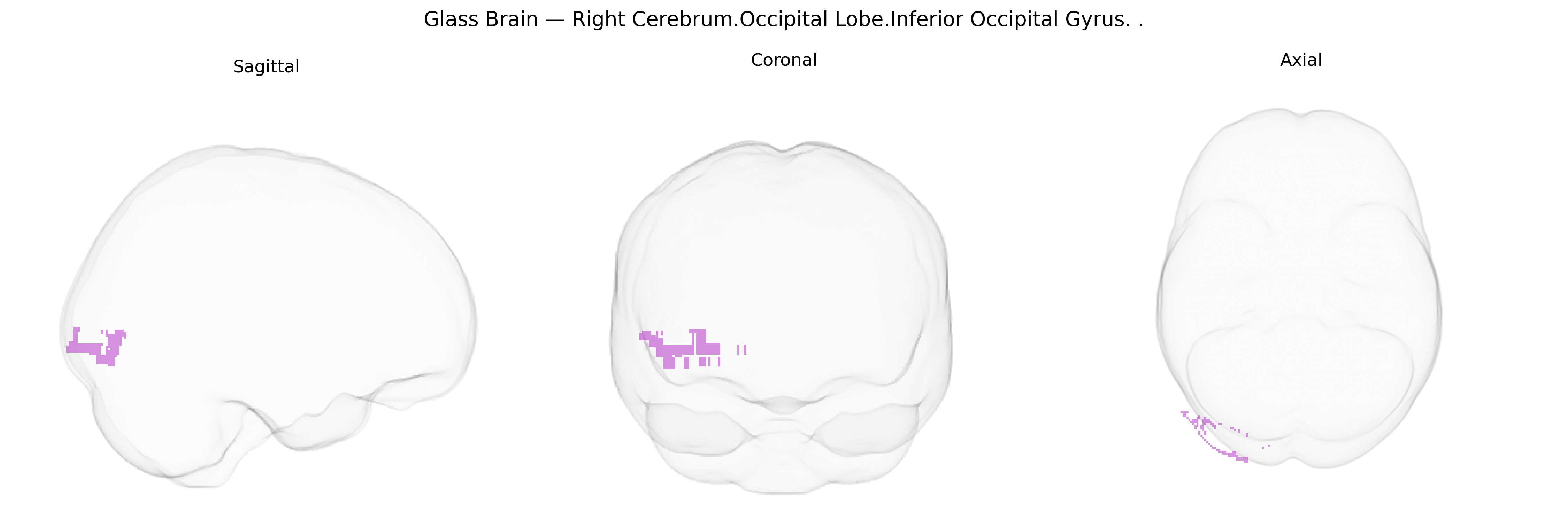 Triplanar Ghost Brain