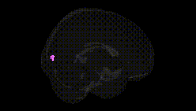 Full Brain Black