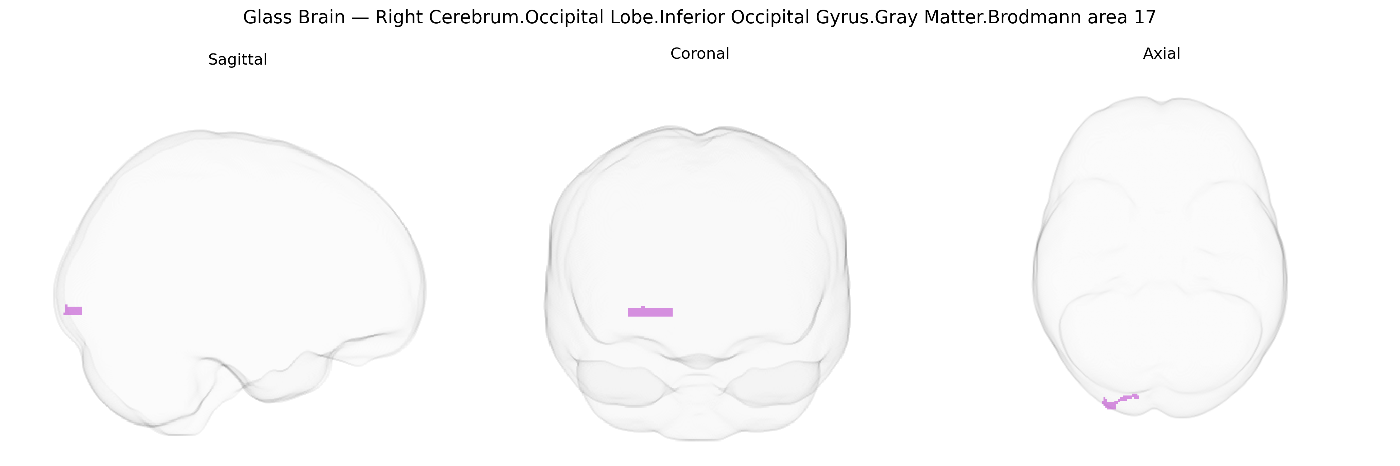 Triplanar Ghost Brain