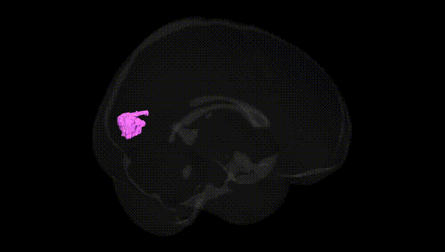Full Brain Black