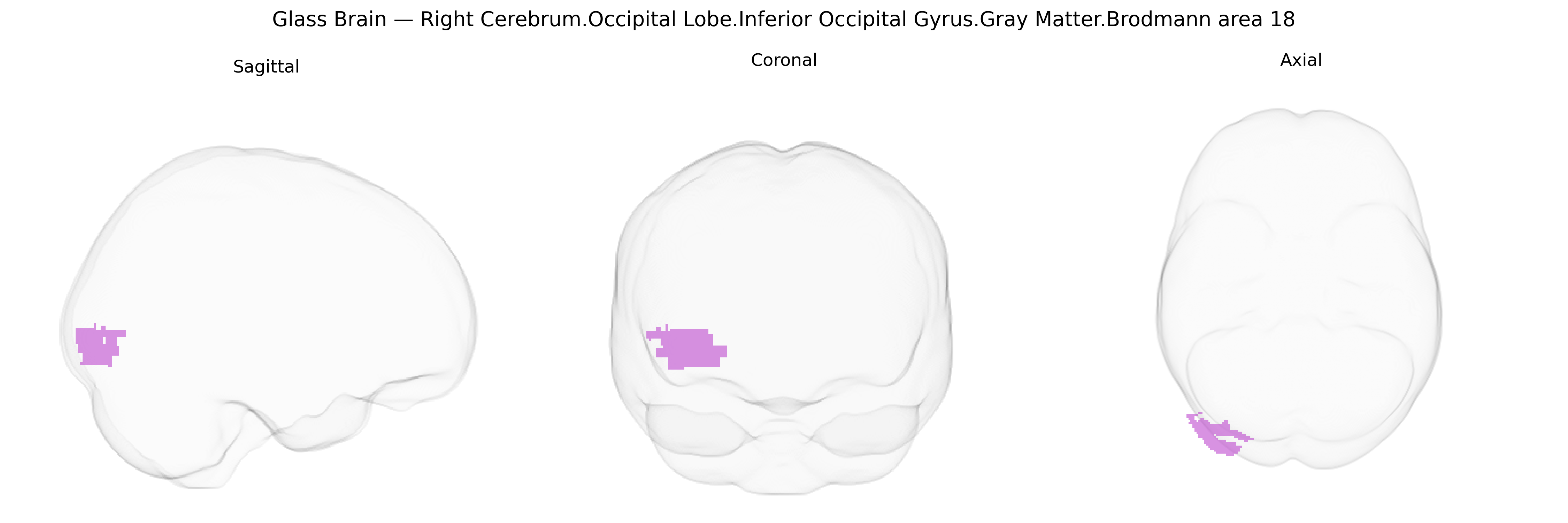 Triplanar Ghost Brain