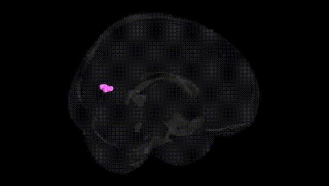 Full Brain Black