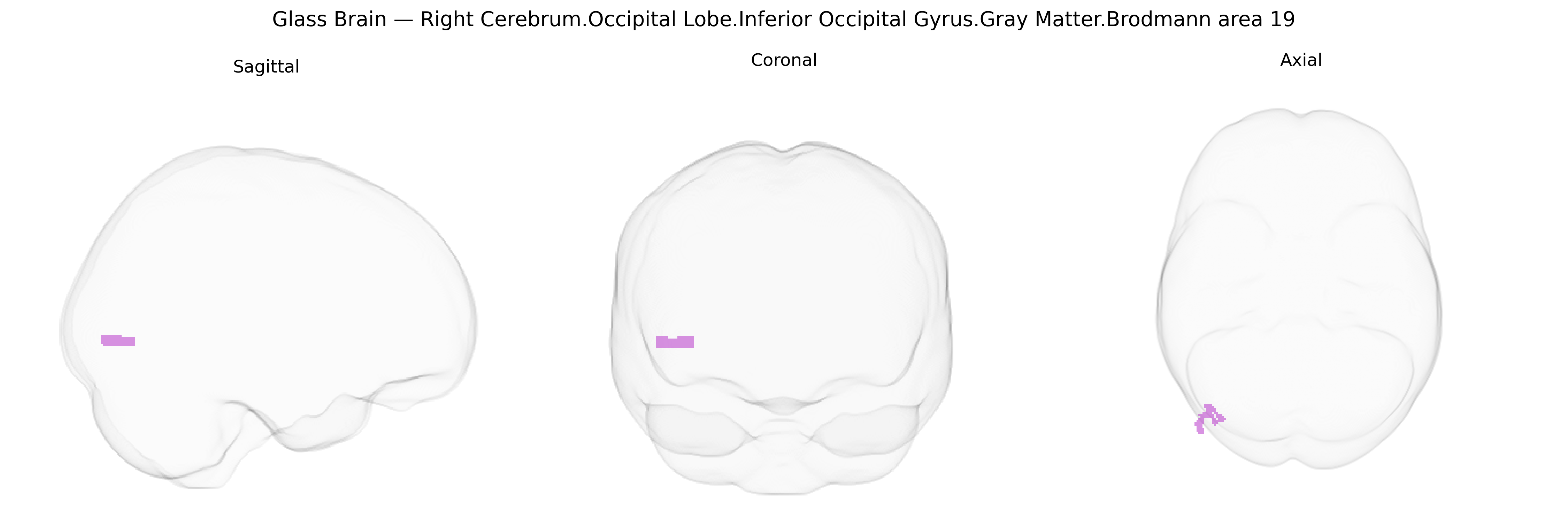Triplanar Ghost Brain