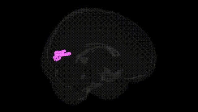Full Brain Black
