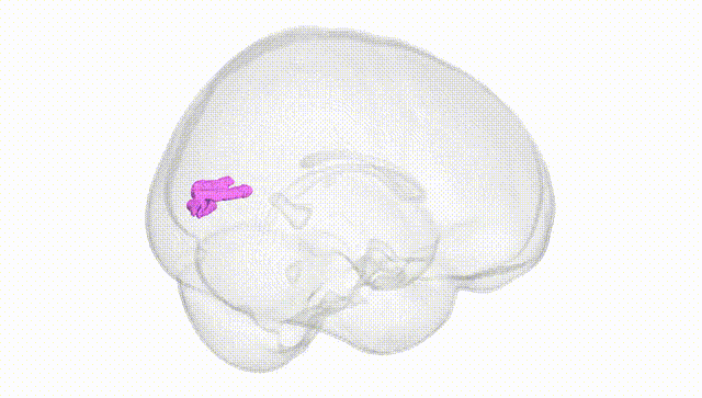 Full Brain White