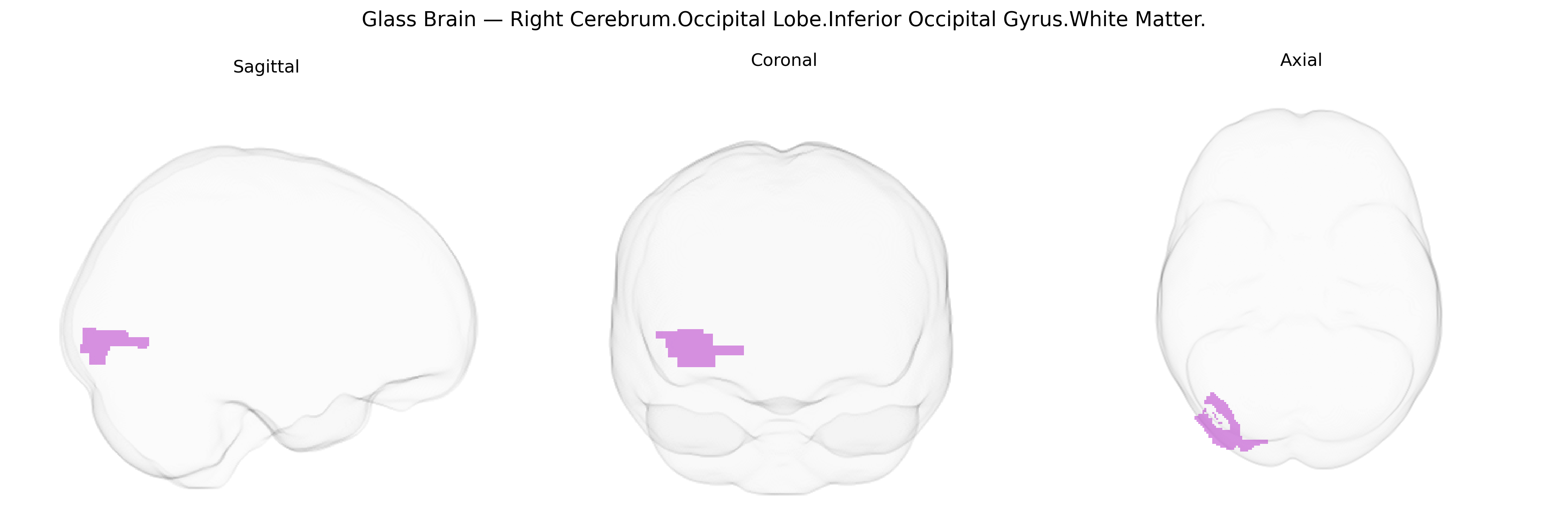 Triplanar Ghost Brain