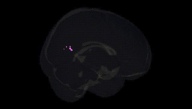 Full Brain Black