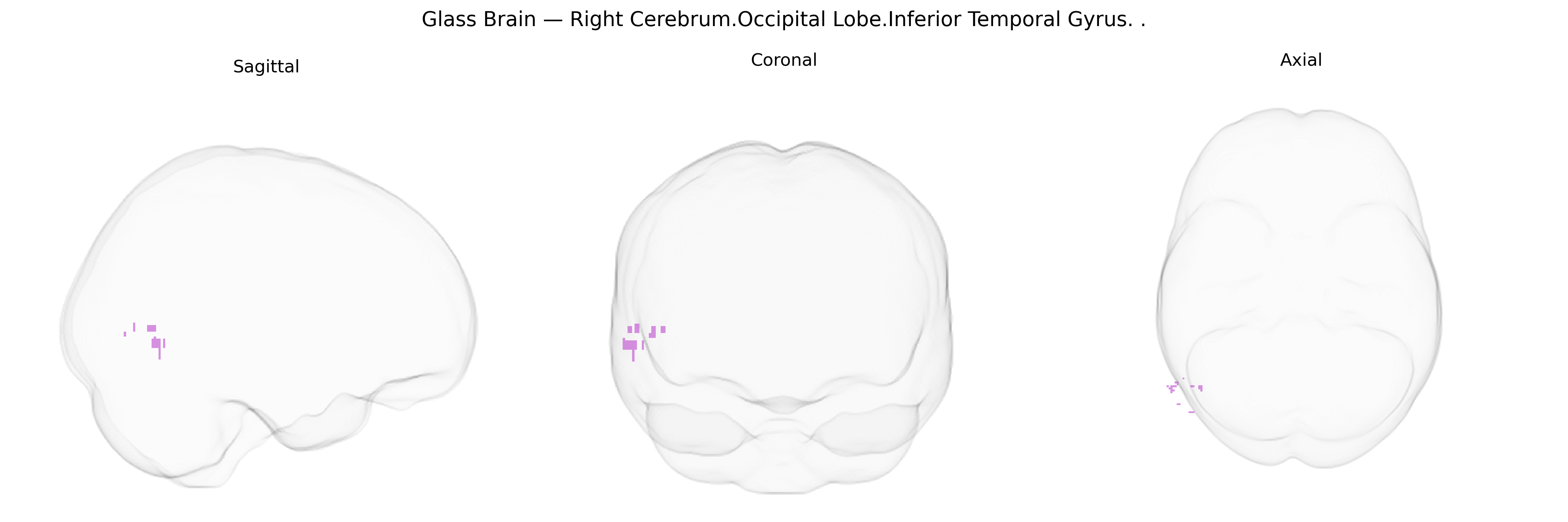 Triplanar Ghost Brain