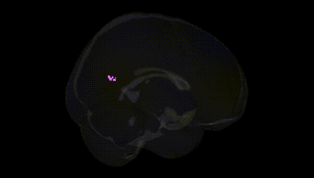 Full Brain Black