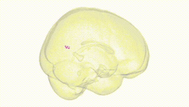 Full Brain White