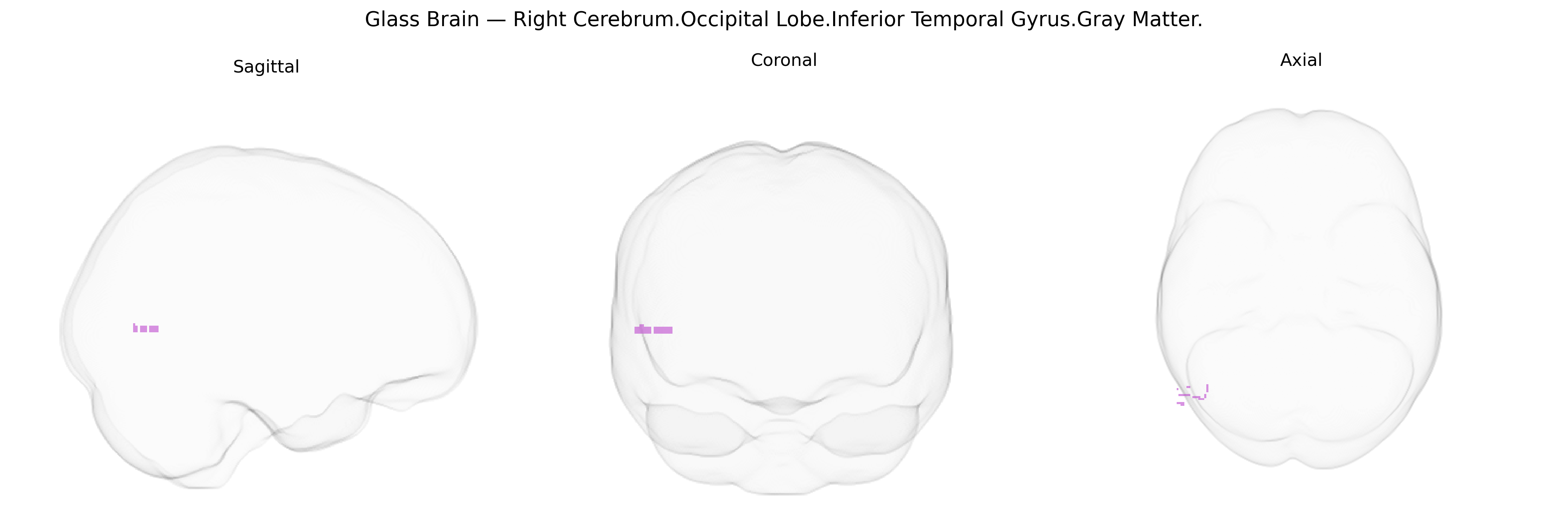 Triplanar Ghost Brain