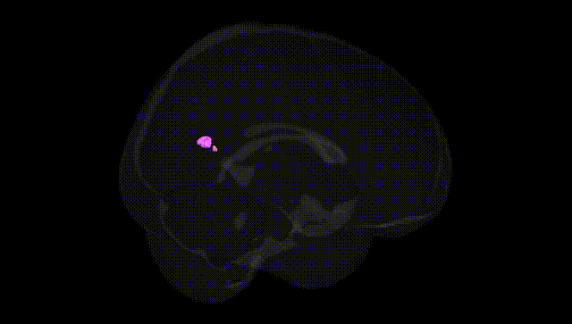 Full Brain Black