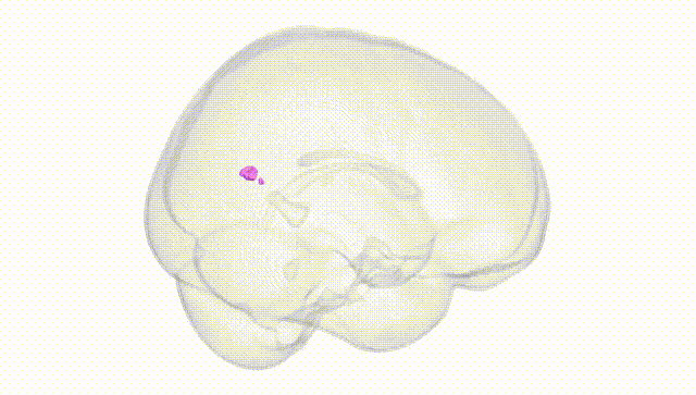 Full Brain White