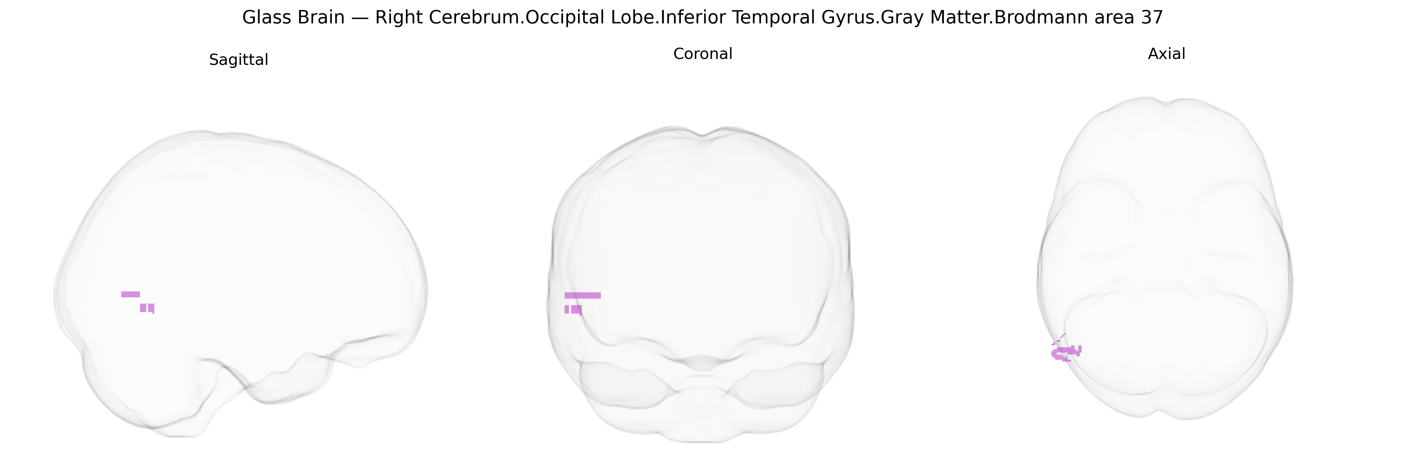 Triplanar Ghost Brain