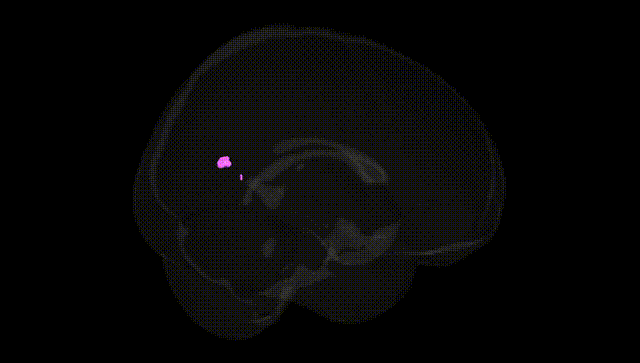 Full Brain Black