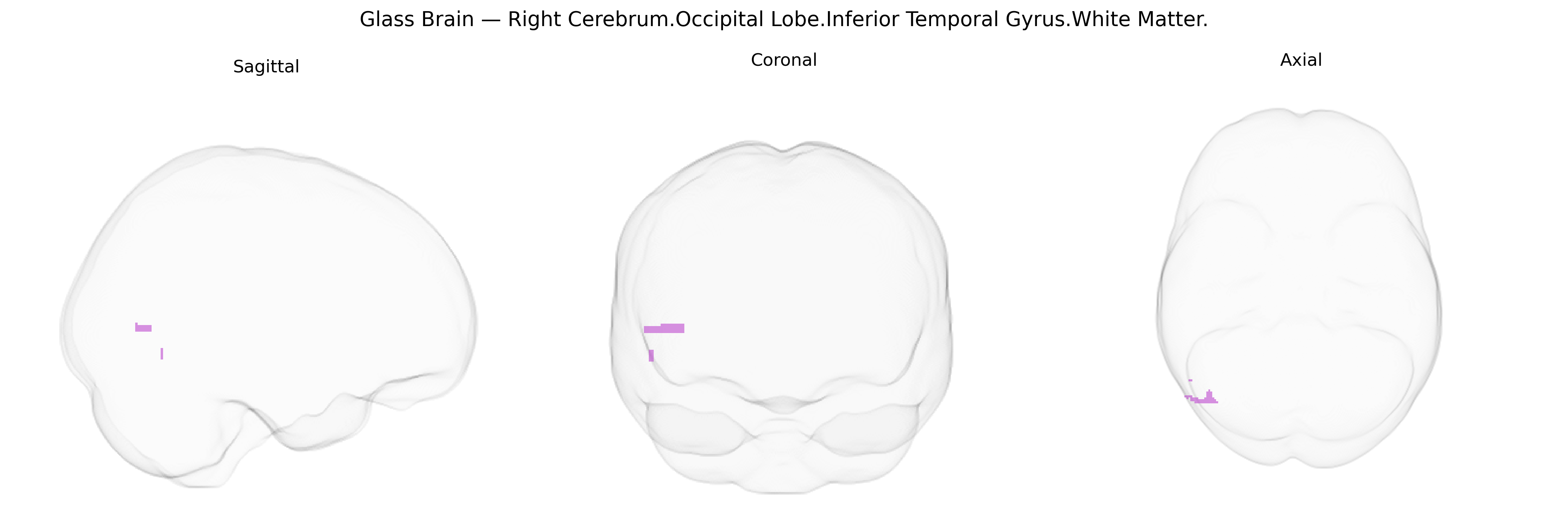 Triplanar Ghost Brain