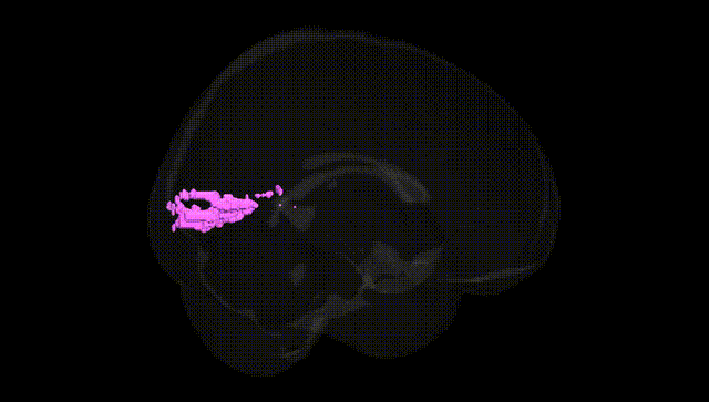 Full Brain Black