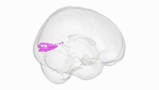 Full Brain White