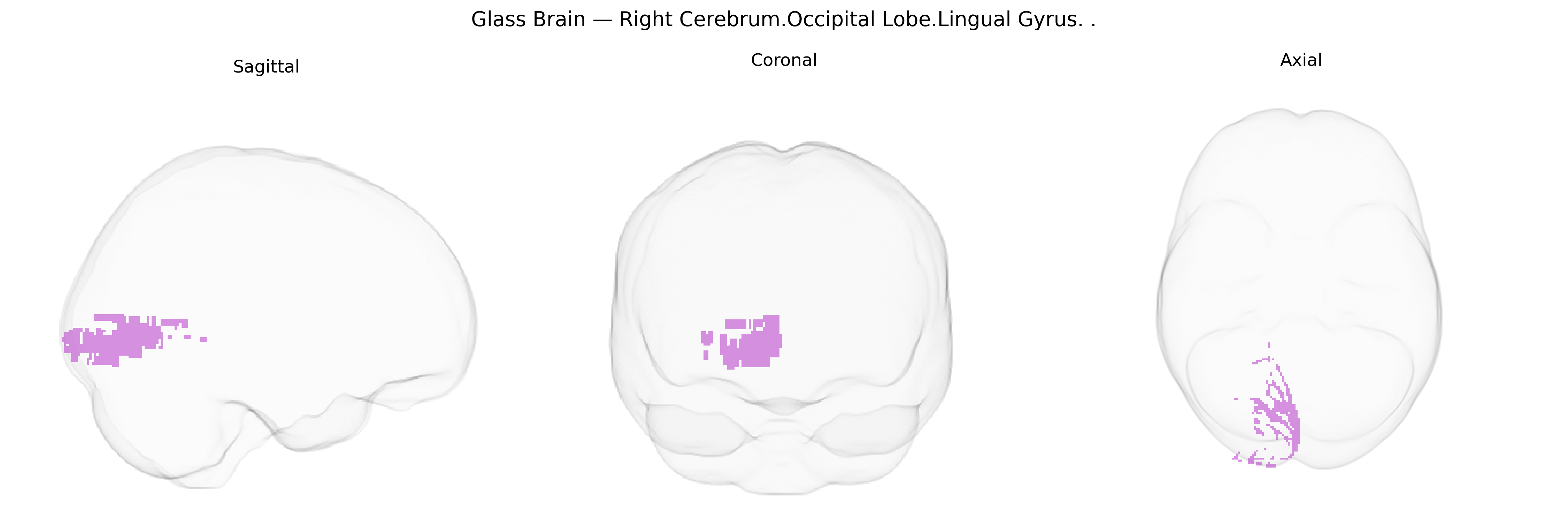 Triplanar Ghost Brain