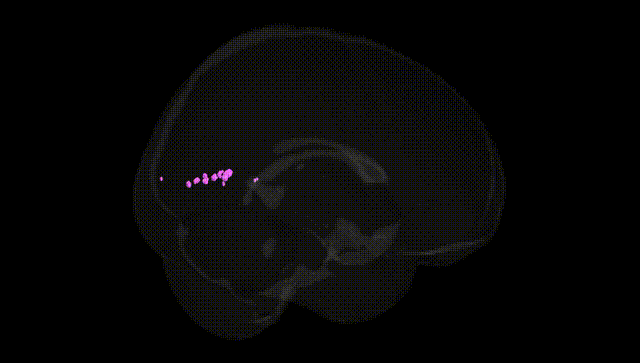 Full Brain Black