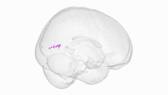 Full Brain White