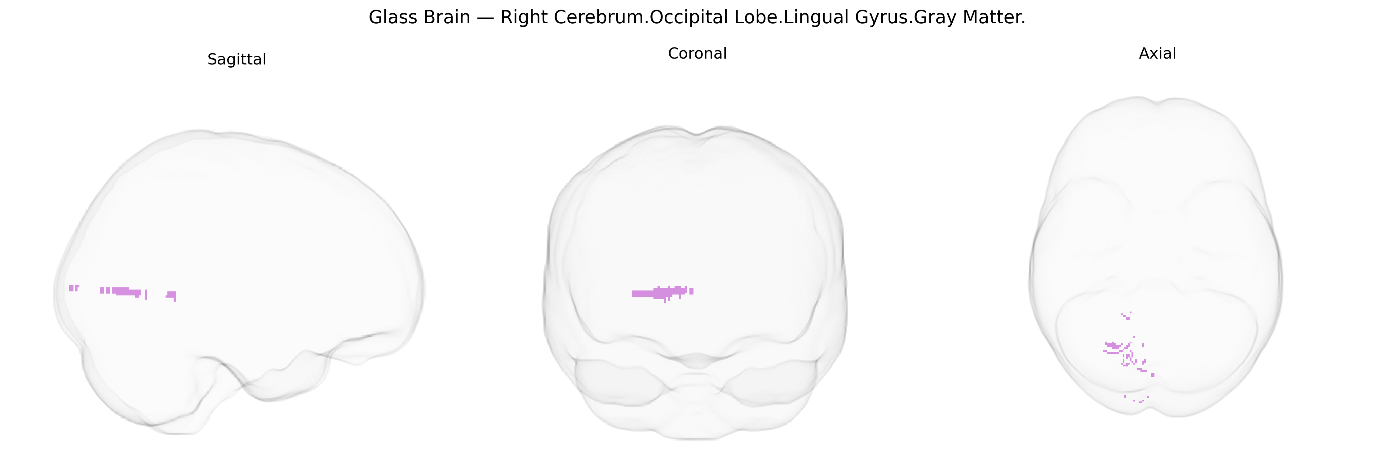 Triplanar Ghost Brain