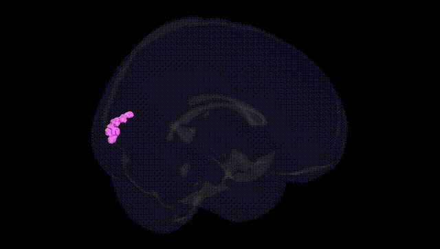 Full Brain Black