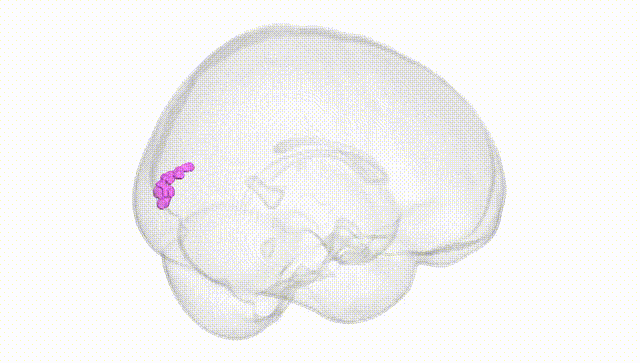 Full Brain White