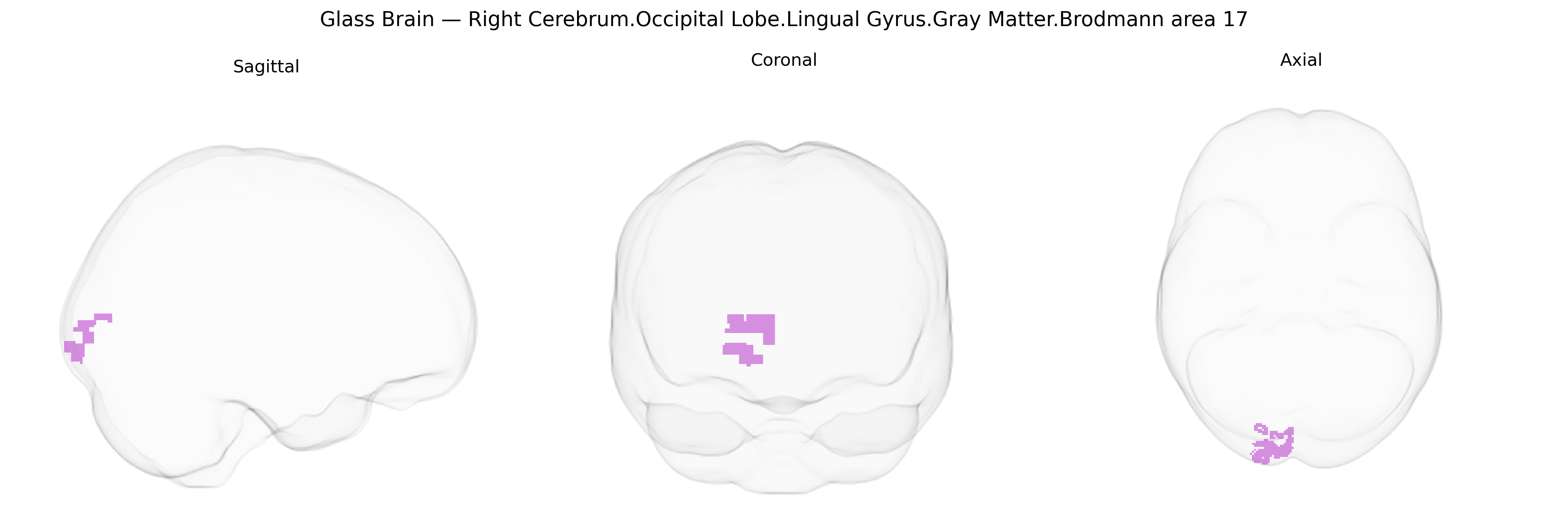 Triplanar Ghost Brain