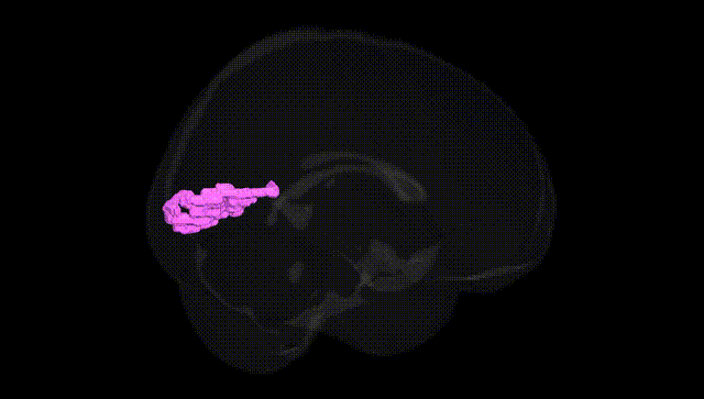 Full Brain Black