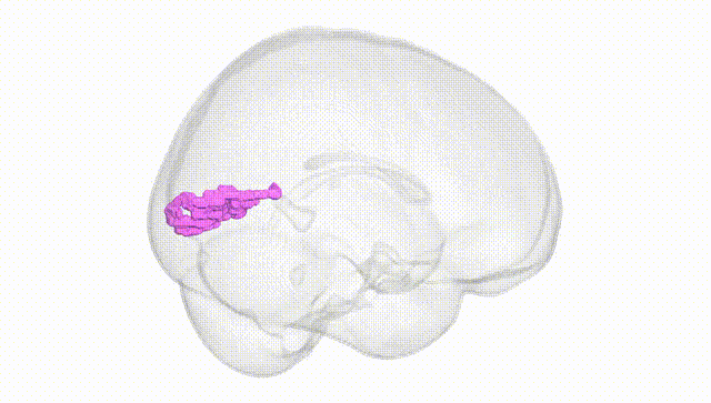 Full Brain White