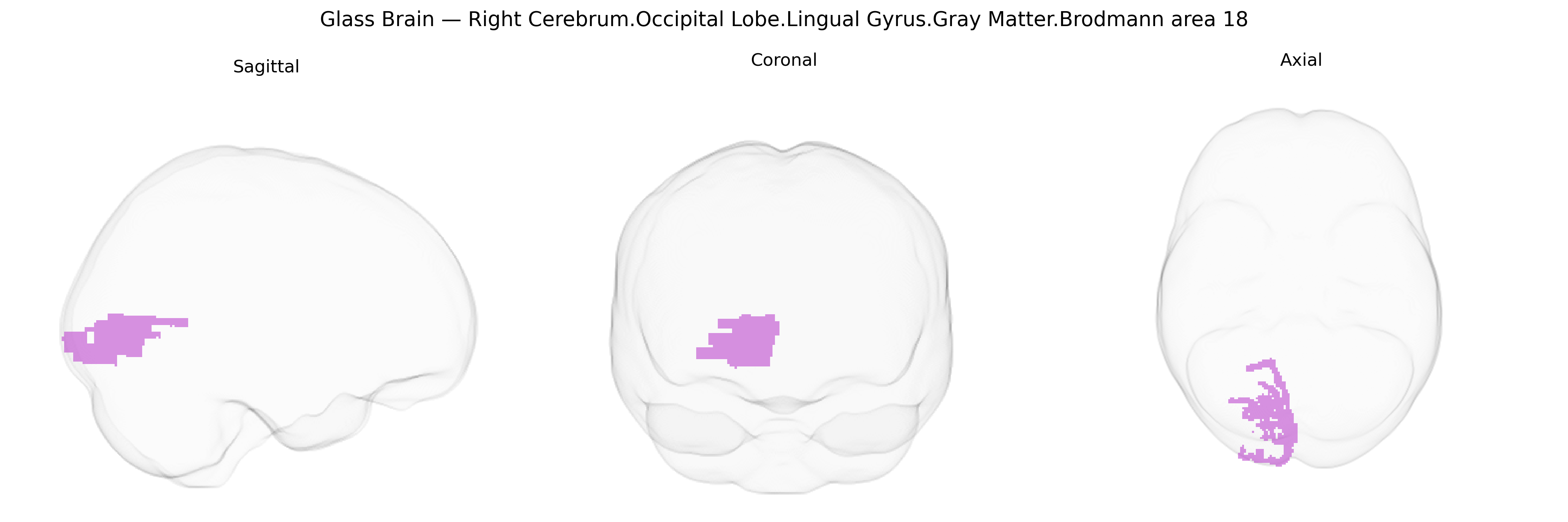 Triplanar Ghost Brain