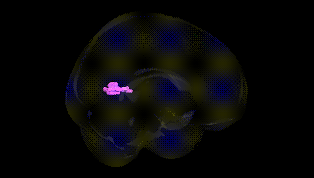 Full Brain Black