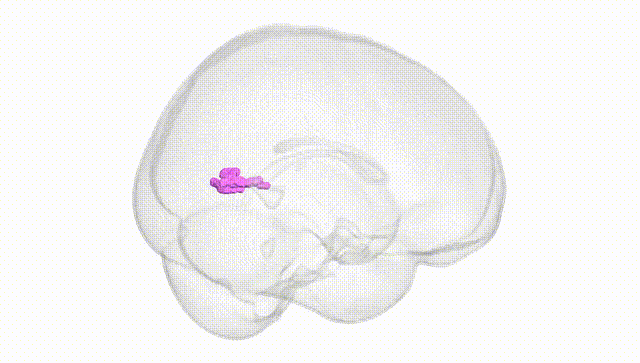 Full Brain White