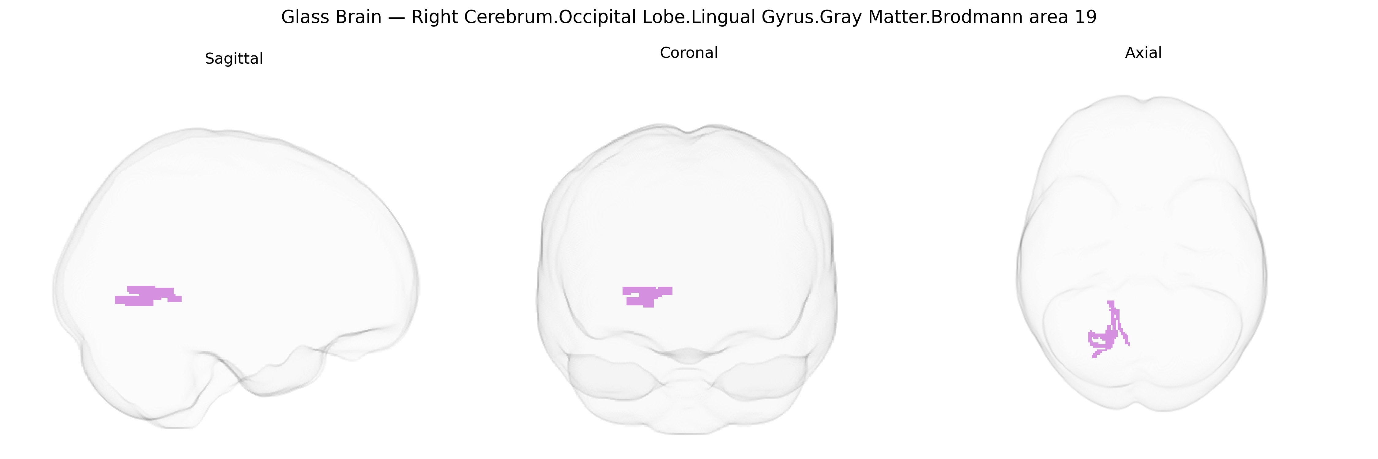 Triplanar Ghost Brain