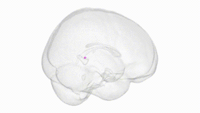 Full Brain White