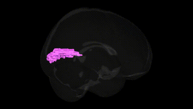 Full Brain Black